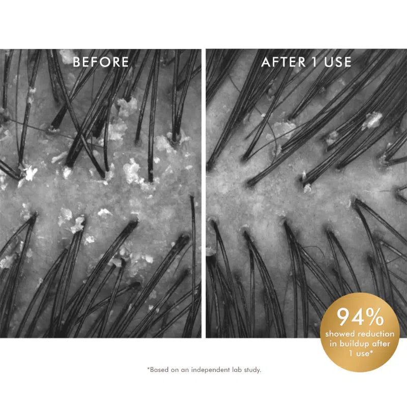 Scalp Purifying Scrub-Moroccanoil