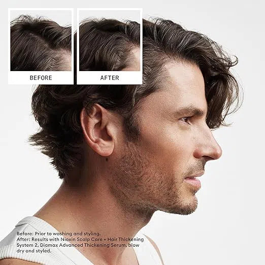 System 2 Starter Kit-Nioxin