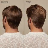 Regeniplex Root Lift Foam