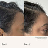 Scalp Care Density Serum-Living Proof