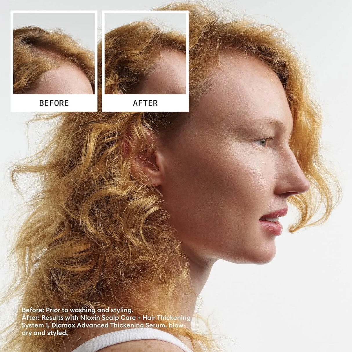 System 1 Scalp Care + Hair Thickening Treatment-Nioxin