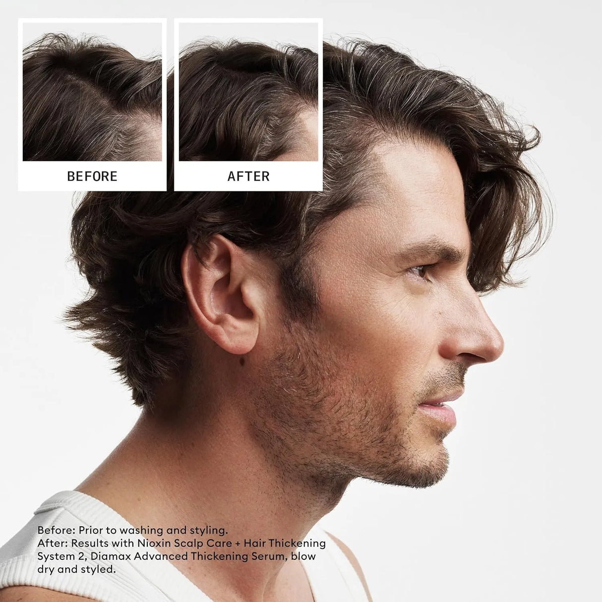 System 2 Scalp Therapy Conditioner-Nioxin