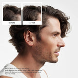 System 2 Scalp Therapy Conditioner-Nioxin