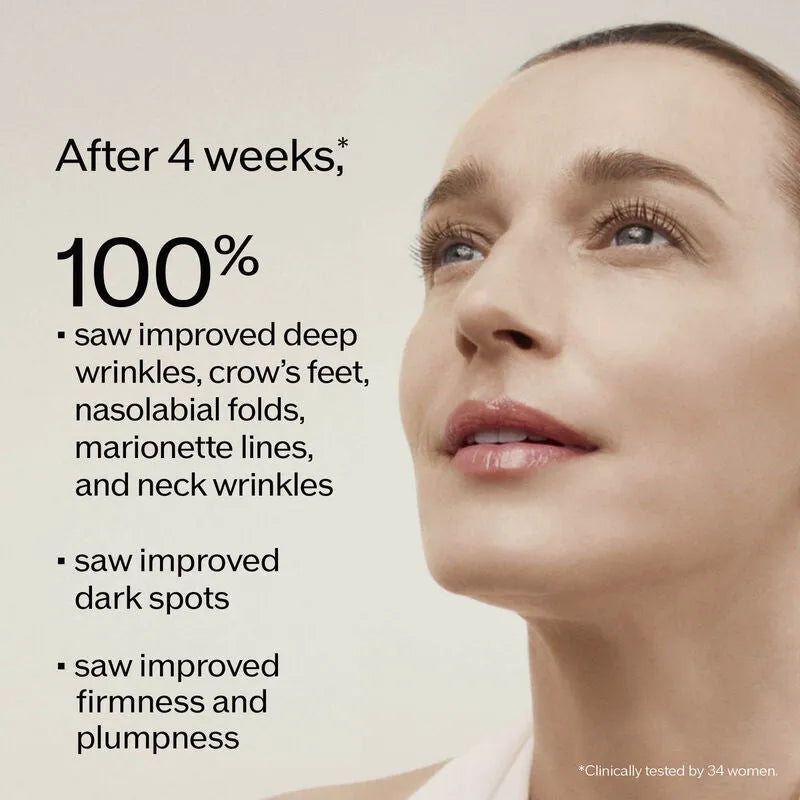 Vital Perfection Intensive Wrinklespot Treatment A+-Shiseido