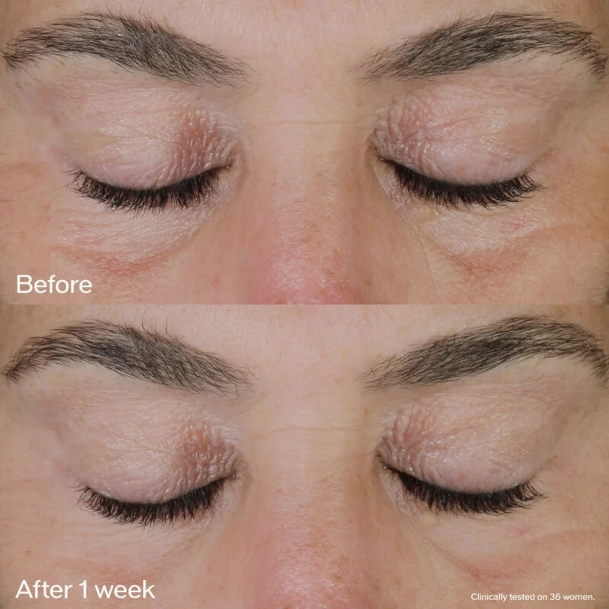 Vital Perfection Uplifting and Firming Eye Cream-Shiseido