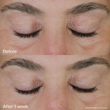 Vital Perfection Uplifting and Firming Eye Cream-Shiseido